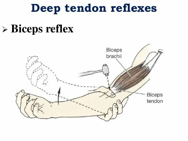 Рефлекс плеча. Рефлекс двуглавой мышцы. Рефлекс сухожилия двуглавой мышцы. Бицепс и трицепс рефлексы. Исследование рефлекса сухожилия двуглавой мышцы плеча.