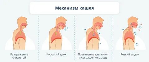Кашель после бронхита форум