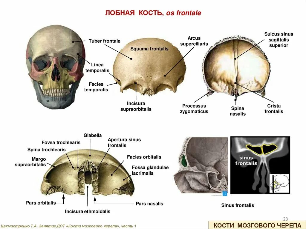 Образование кости черепа. Строение лобной кости черепа человека анатомия. Лобная кость glabella. Лобная кость os frontale. Лобная кость спереди анатомия.