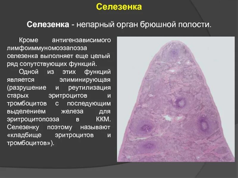 Селезенка и эритроциты. Селезенка кладбище эритроцитов. Селезенка кладбище тромбоцитов. Кладбище эритроцитов какой орган.