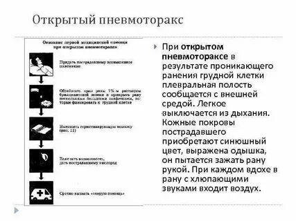 Оказание первой помощи при пневмотораксе
