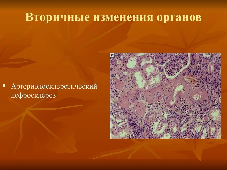 Вторичные изменения