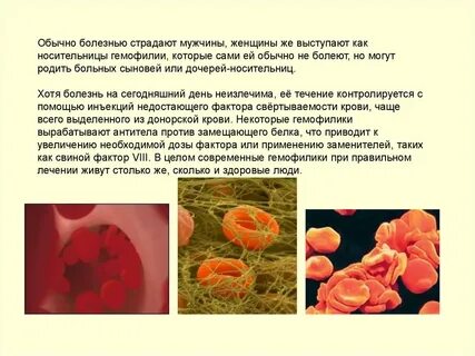 Обычная болезнь