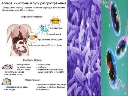 Возбудителями какого заболевания являются вирусы холера чума
