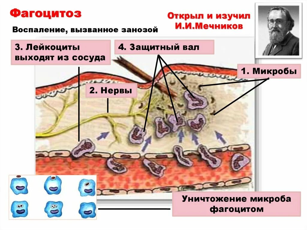 Воспаление фагоцитоз лейкоцит безразличный раздражитель микроворсинка. Фагоцитоз воспаление. Мечников фагоцитоз. Клеточный иммунитет фагоцитоз. Фагоцитоз анатомия.