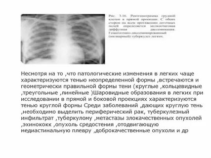 Что значит изменения в легких