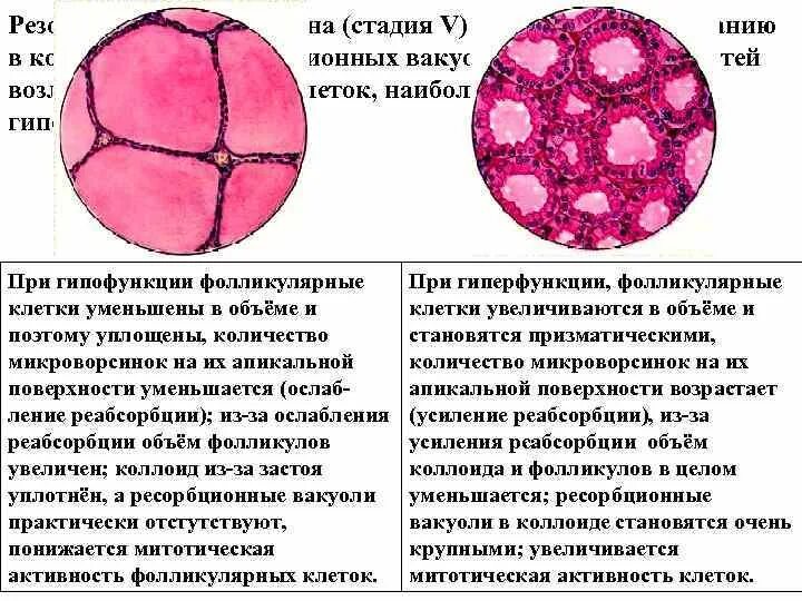 Митотическая активность клеток. Гиперфункция щитовидной железы гистология. Щитовидная железа гистология. Тироциты щитовидной железы гистология. Строение фолликула щитовидной железы гистология.