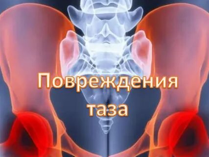 Повреждение таза и тазовых органов