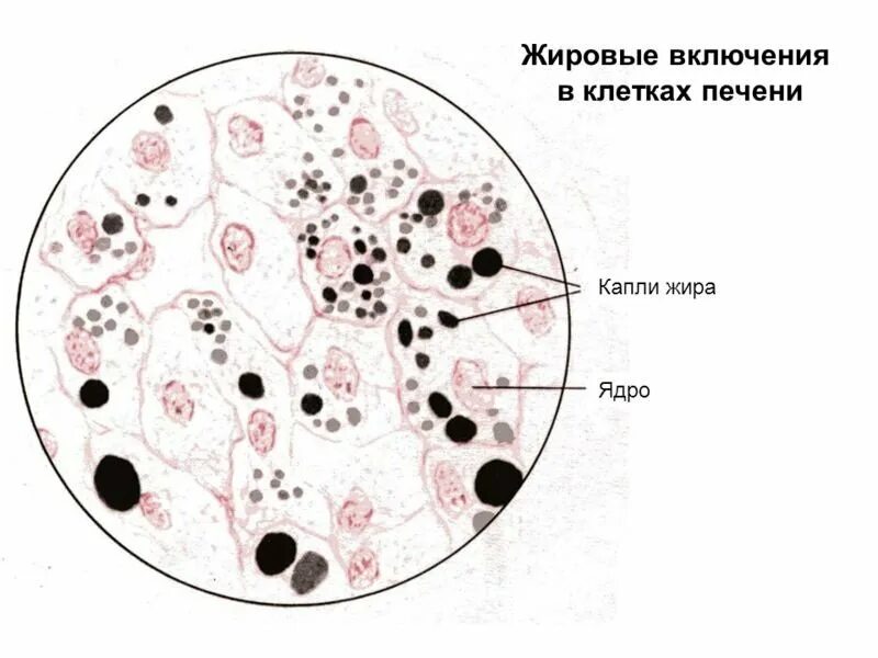 Включения жира в клетках печени. Включения жира в клетках печени аксолотля. Препарат жировые включения в клетках печени аксолотля. Жировые включения в клетках печени рисунок.