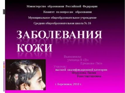 Кожные заболевания презентация 8 класс