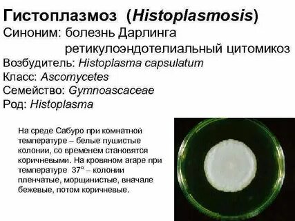 Легкие возбудитель