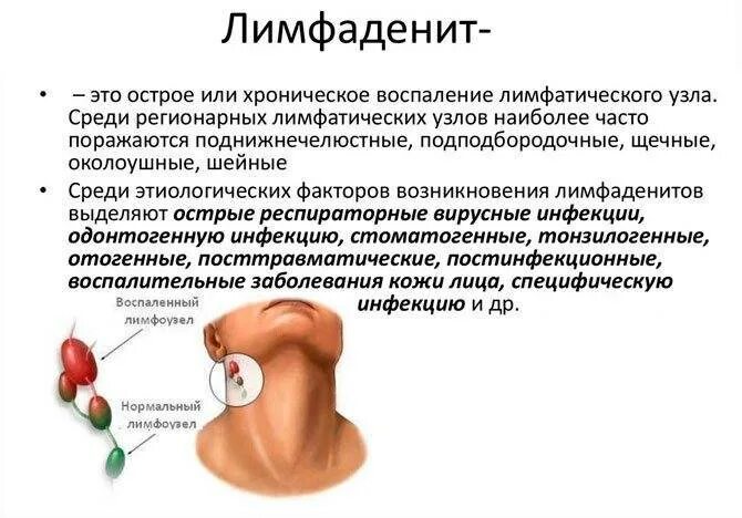 Болят лимфоузлы под челюстью причины