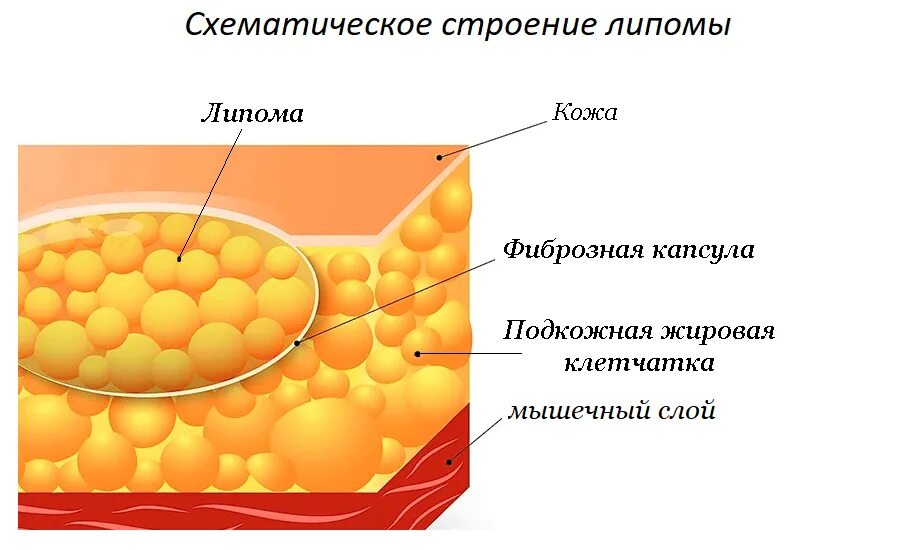 Рассосать уплотнение на коже