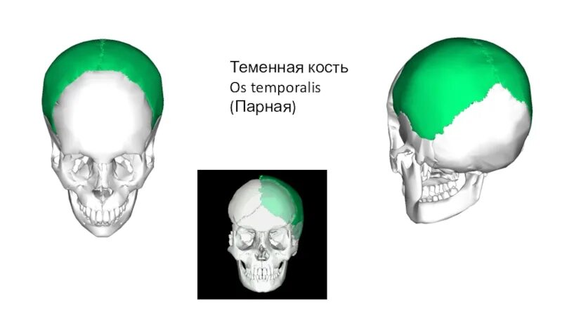 Теменная кость парная. Парные теменные кости. Пара теменных костей. Теменной гребень у обезьян. Парной костью являются