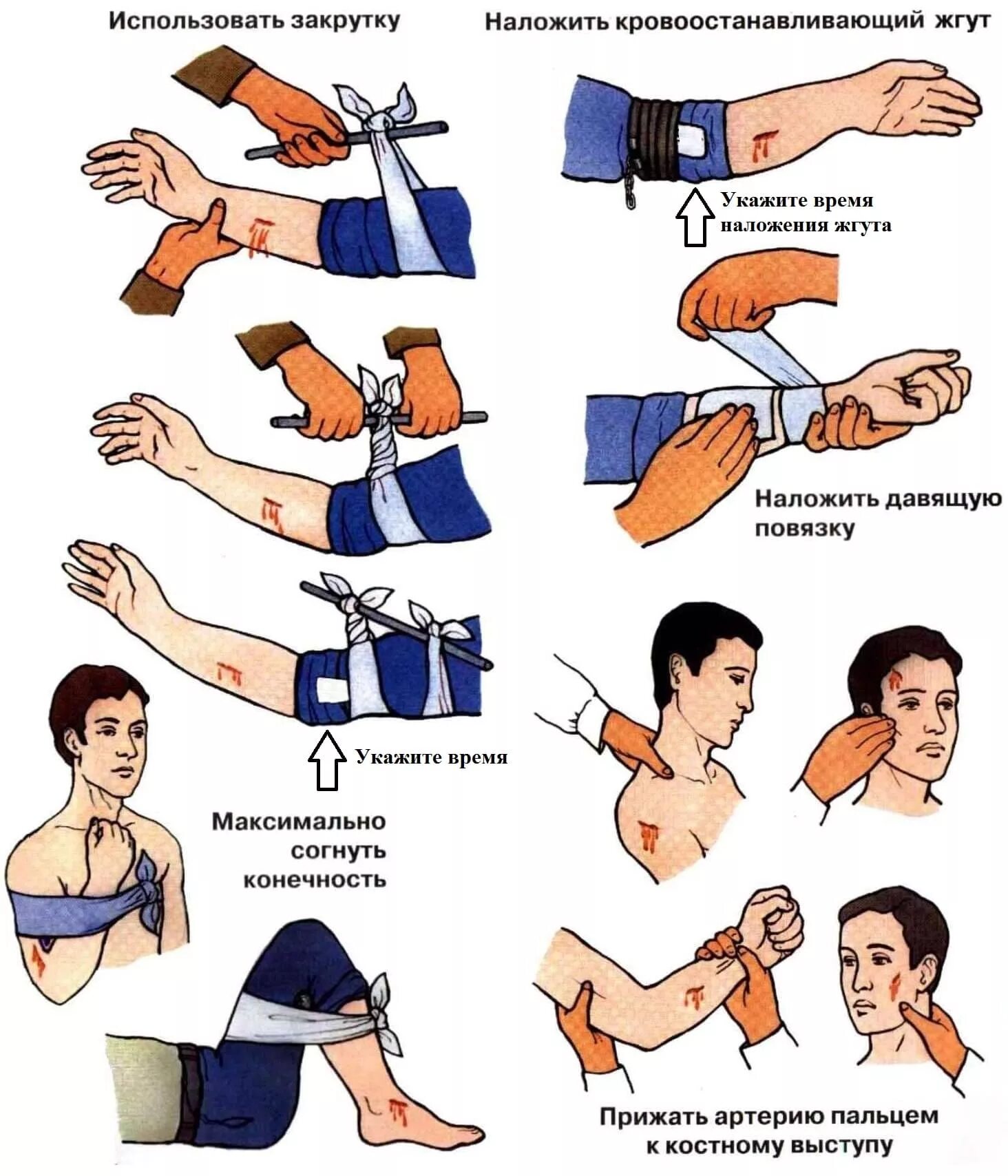 Оказание первой самопомощи. Методы остановки кровотечения при ранении. Остановка кровотечения при травме конечностей. Способы временной остановки кровотечения наложение повязки. Временная остановка кровотечения наложением жгута.