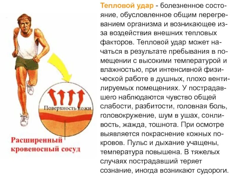 Тепловой удар информация.