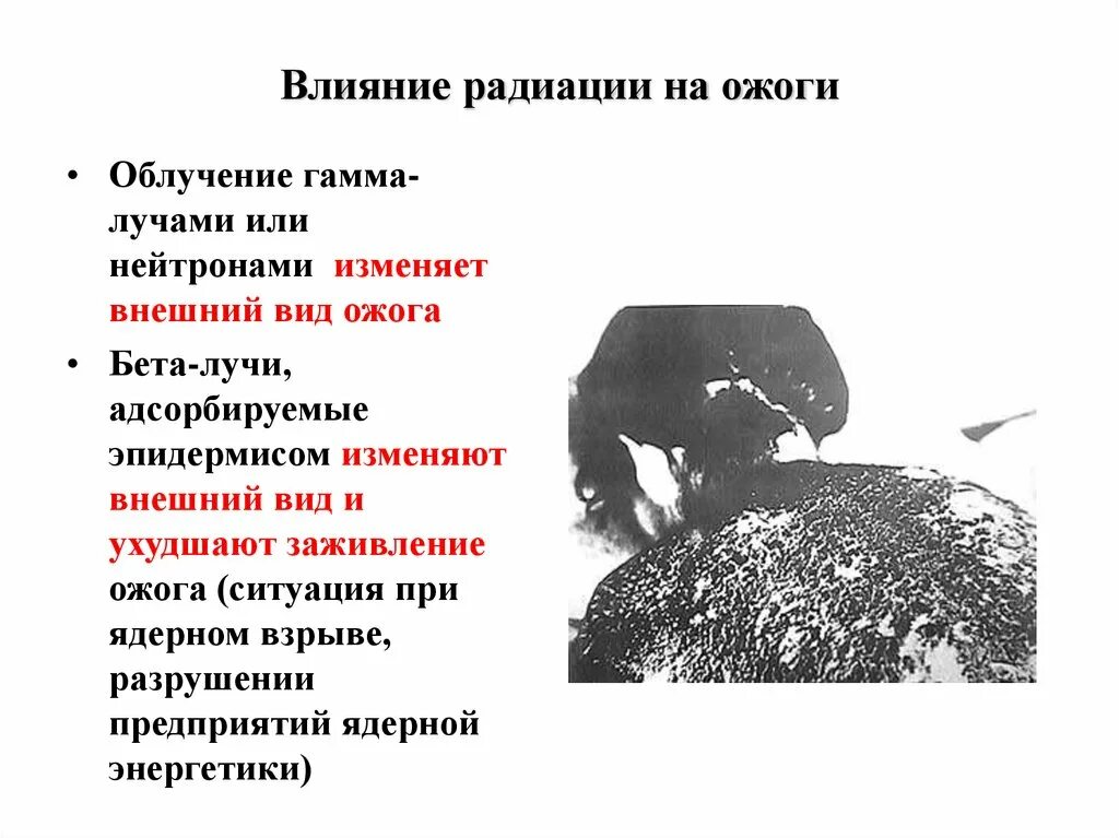 Поражение человека радиацией. Комбинированные поражения презентация. Радиационные поражения презентация. Ожоги от ядерного взрыва.