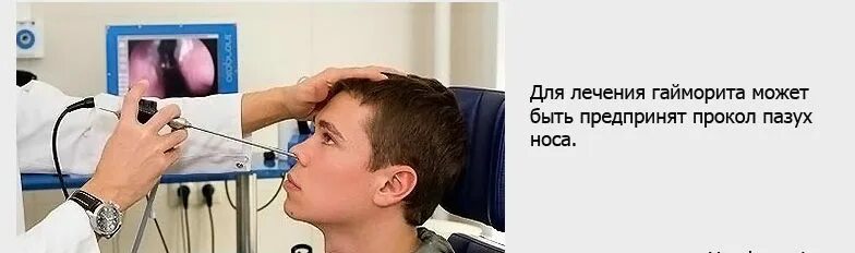Можно ли вылечить гайморит без прокола. Прокол в голове при гайморите. болит голова при гайморите.