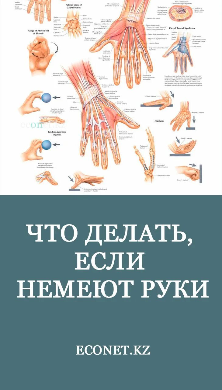 Сильно немеет левая. Немеют руки. Болит рука и немеют пальцы. Кисть руки.