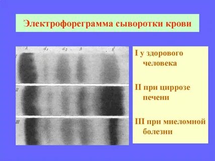 М градиент