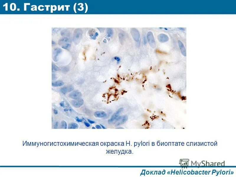 Окраска хеликобактер пилори. Хеликобактер окраска биоптата. Окраска на хеликобактер пилори Гимзе. Биоптат слизистой оболочки