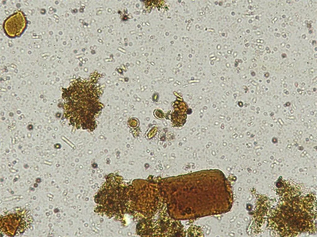 Мышечные волокна в Кале микроскопия. Копрология кала микроскопия. Микроскопия кала эритроциты. Микроскопия кала копрограмма. Споры в кале у взрослого