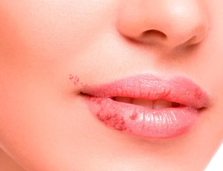 губы с вишней. женщина облизывается. вкус твоих губ хочу. губы с зубами.