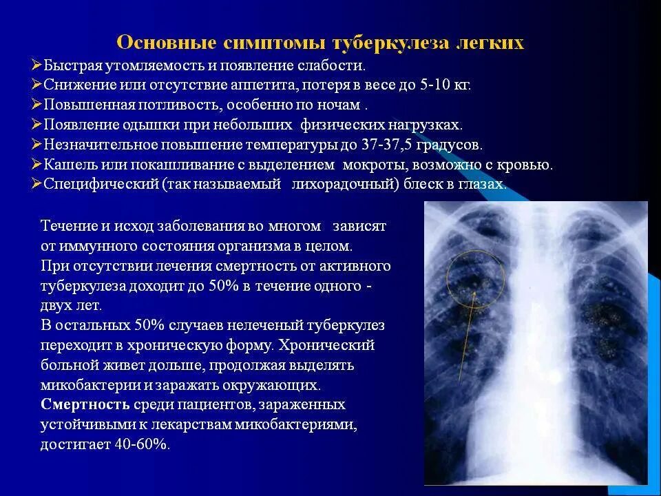 Клинические проявления в начальной стадии туберкулеза. Симптомы туберкулеза легких. Легочные проявления туберкулеза. Симптомы при туберкулезе легких.