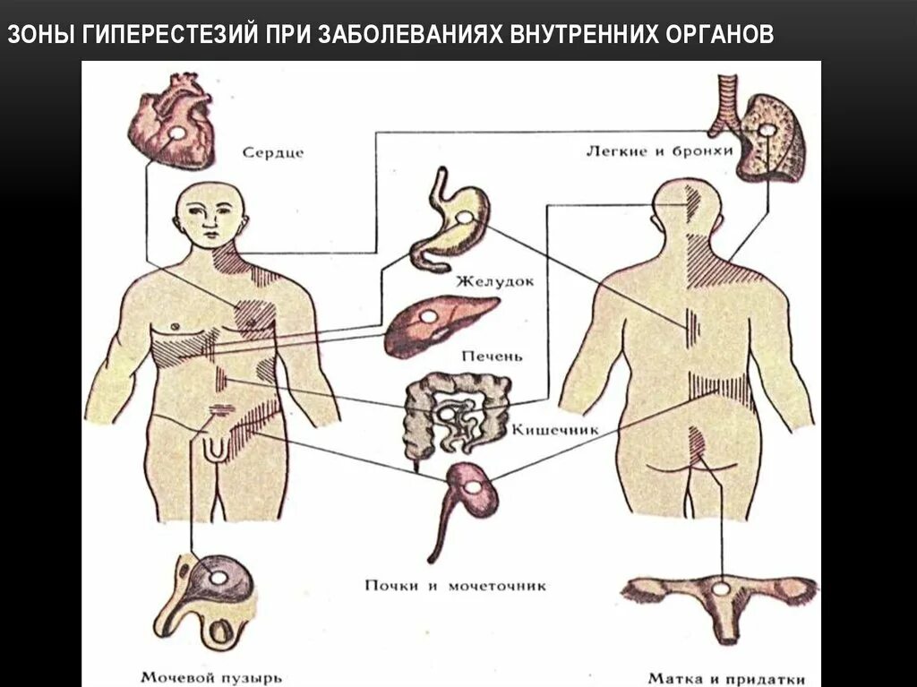 Симптомы заболеваний внутренних органов. Заболевания внутренних органов. хронические заболевания внутренних органов. поражения кожи при болезнях внутренних органов. воспаление внутренних органов.