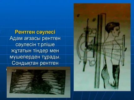 Киім арқылы кеуделер көрінеді