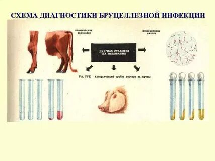 Бруцеллез диагностика