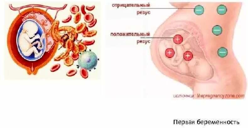 Резус конфликт физиология. Резус-конфликт при беременности. Конфликт матери и плода. Положительный резус фактор матери и отрицательный плода. Отрицательный резус у мужчины беременность