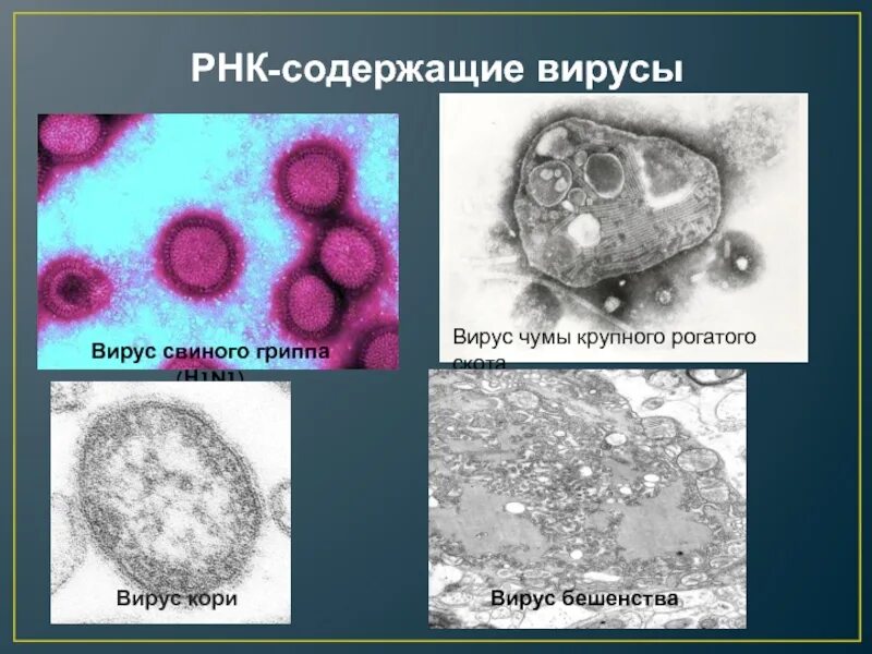 Чума заболевание вызываемые бактериями