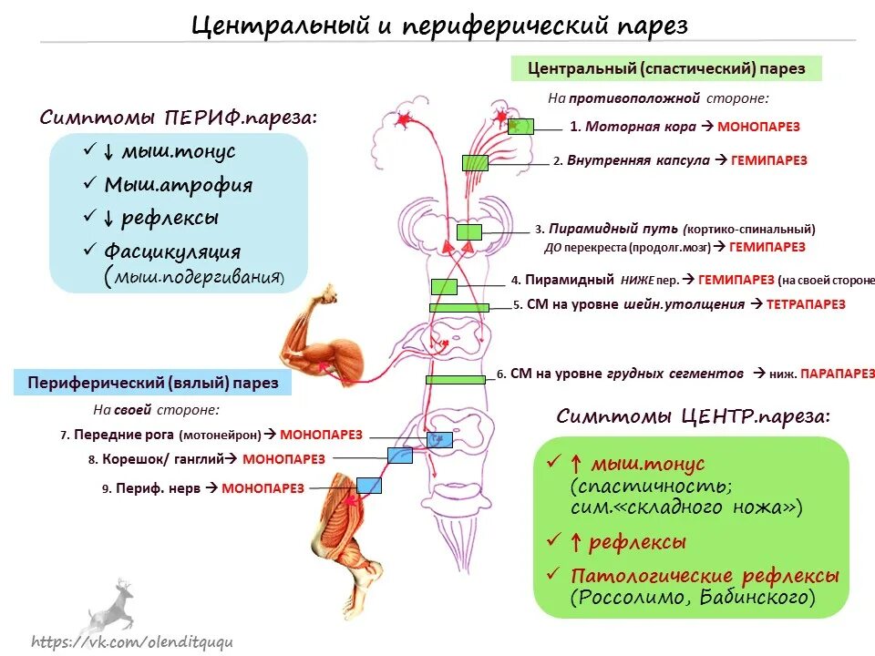 Симптоматика центрального и периферического паралича. Гемипарез центральный и периферический. Симптомы центрального и периферического паралича таблица. Центральный и периферический парез отличия. Центральный и периферический парез лицевого нерва неврология.