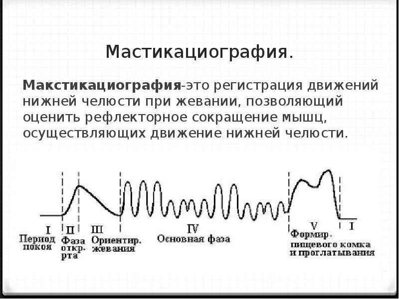 Мастикациография принцип метода. 5 Фаз жевательного периода. Мастикациография фазы жевания. Метод мастикациографии физиология. Регистрация передвижения