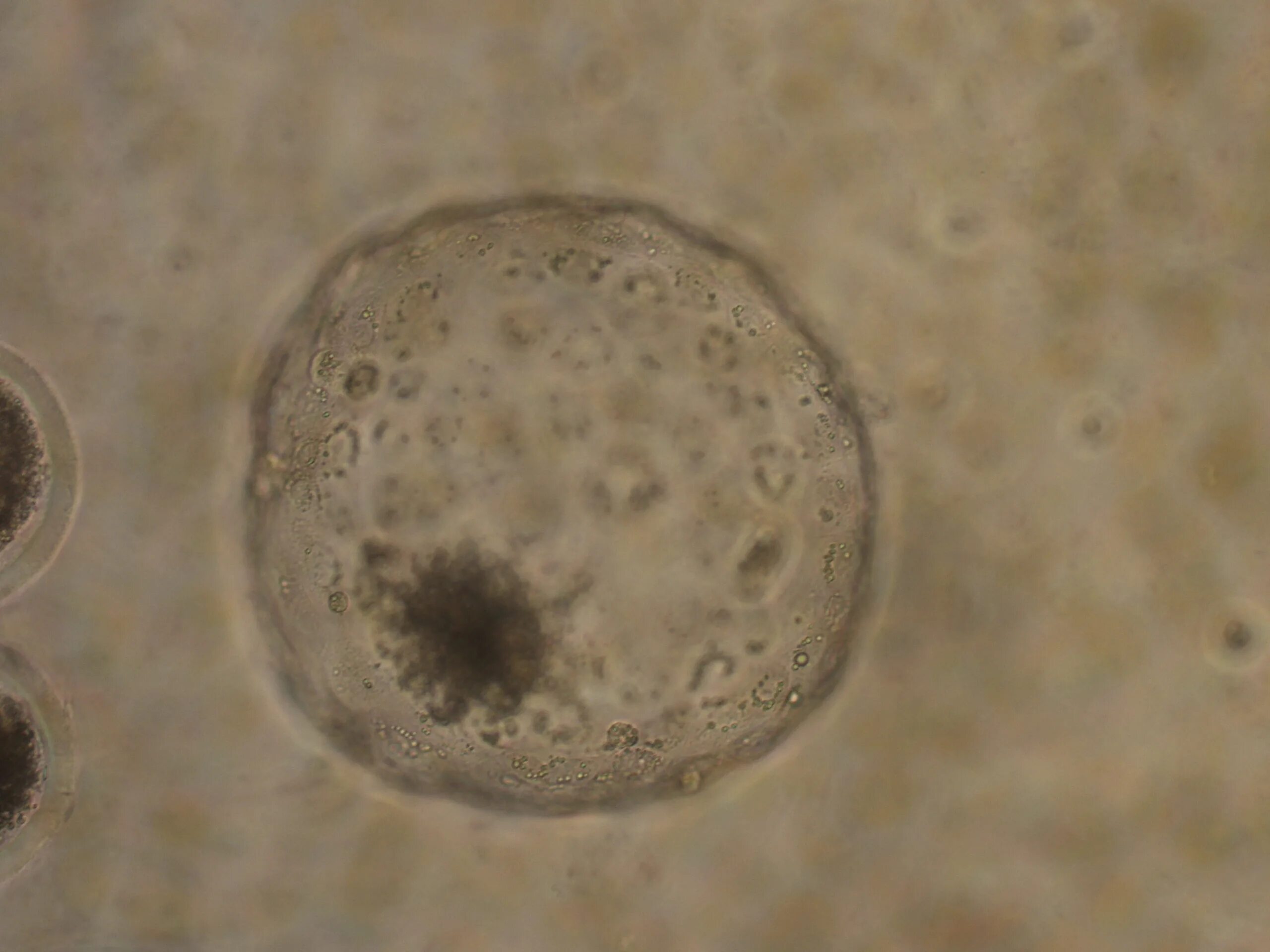 Бластоциста хоминис в кале. Blastocystis hominis. Микроскопия blastocystis hominis. Бластоциста хоминис. Бластоцисты в кале под микроскопом.