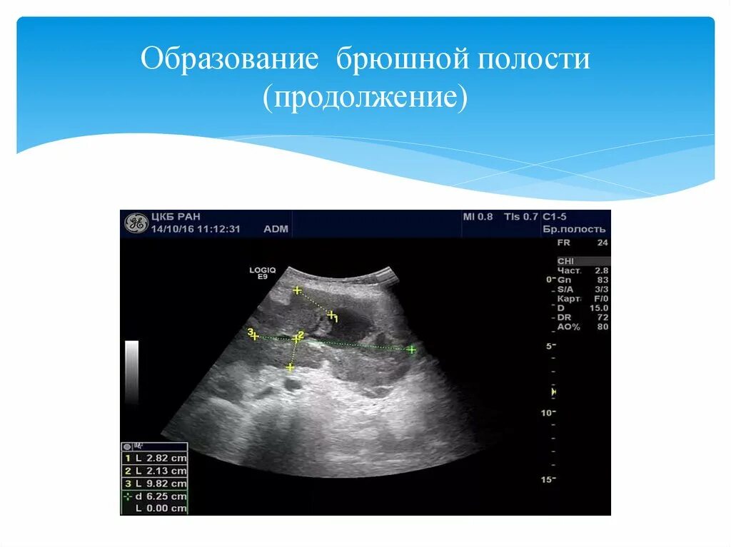 Образование брюшной полости УЗИ. Кишечник на УЗИ брюшной полости. УЗИ брюшной полости подготовка. Подготовка ребенка к УЗИ органов брюшной полости. Узи органов брюшной полости подготовка у женщин