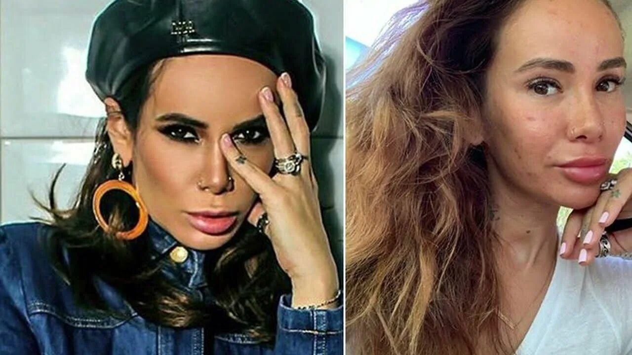 20 фото звезд, доказывающих, что их красота подарена вовсе не природой Lisa.ru