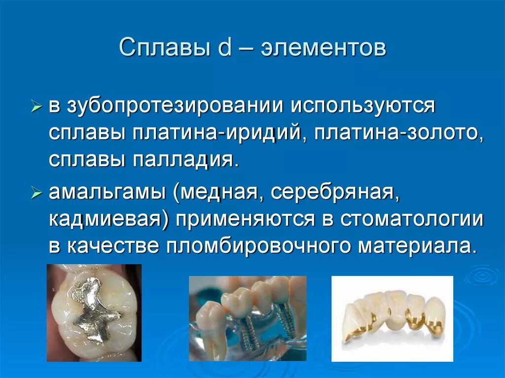 Входит в амальгаму