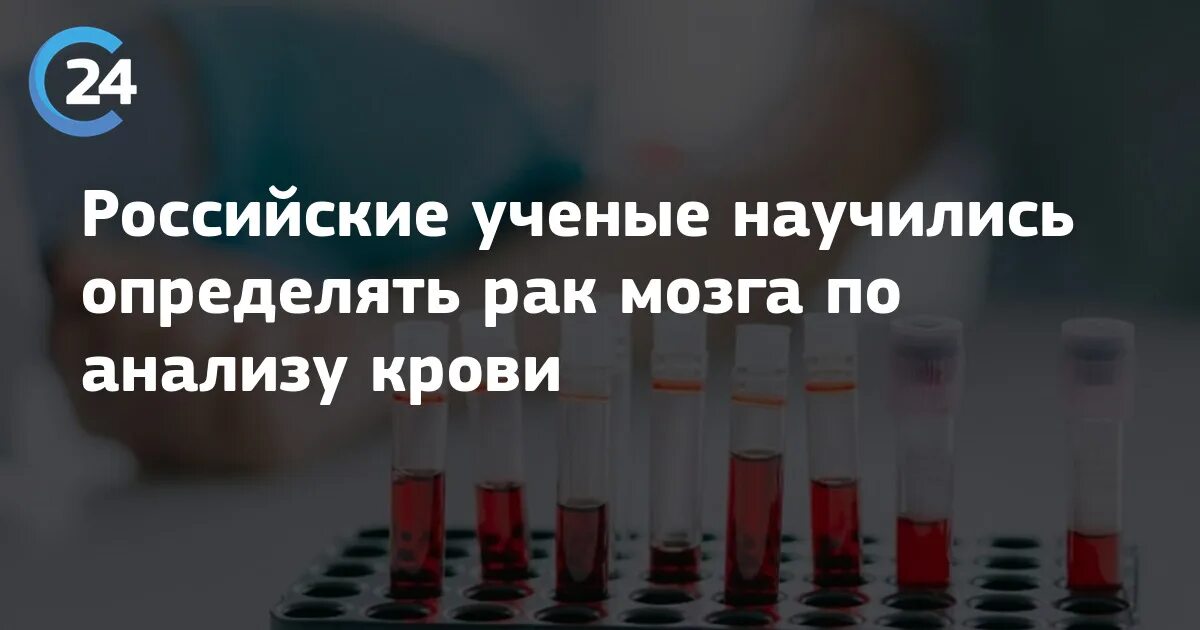 Рак мозга анализы крови. По анализу крови выявили онкологию. РФ анализ крови что это.