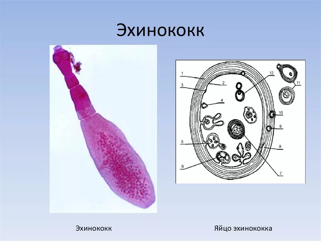 Какой цифрой на рисунке обозначена яйцо эхинококка. Эхинококковая финна строение. echinococcus granulosus яйцо строение. финна альвеококка строение.