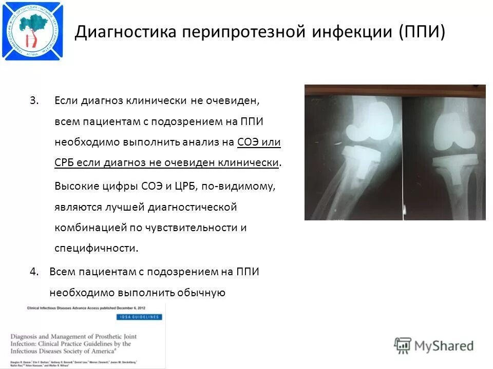 осложнения эндопротезирования. эндопротез тазобедренного сустава рентген. эндопротезирование коленного сустава диагноз. осложнения эндопротезов. осложнения эндопротезирования.