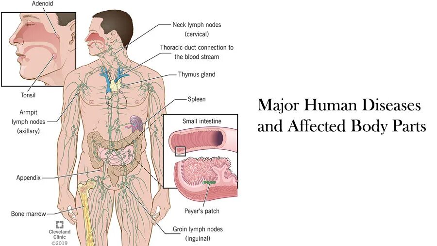 Human disease. Coclopia Human болезнь..