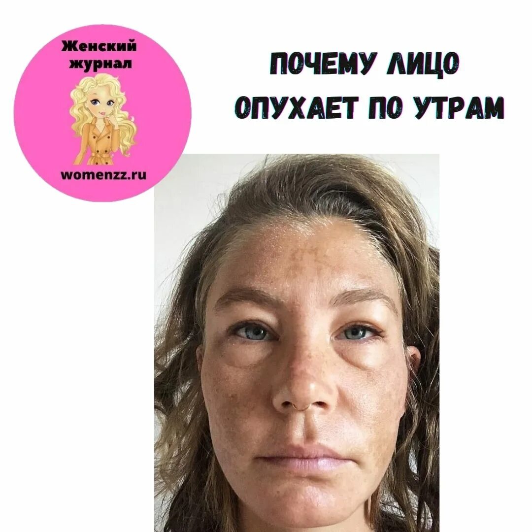 Отекшее лицо по утрам у женщин