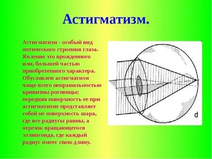Астигматизм цилиндр