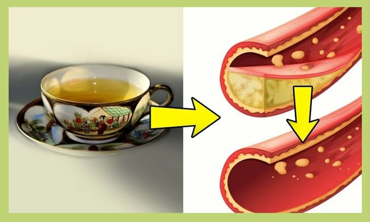 Кофе повышает холестерин в крови. Кофе снижает холестерин. Зеленый чай и холестерин. Чай снижающий холестерин. Зелёный чай снижает холестерин в крови.
