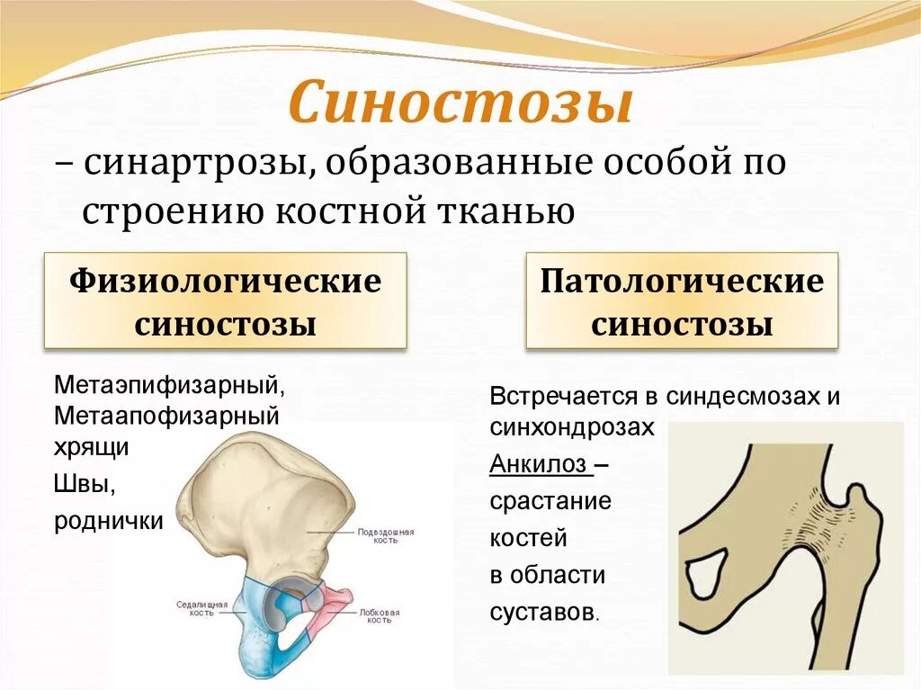 Подвижное соединение какие кости. Костные соединения синостозы. Синостоз соединение костей. Непрерывные соединения костей синдесмозы синхондрозы синостозы. Соединения позвоночника синхондроз синдесмоз синостоз.