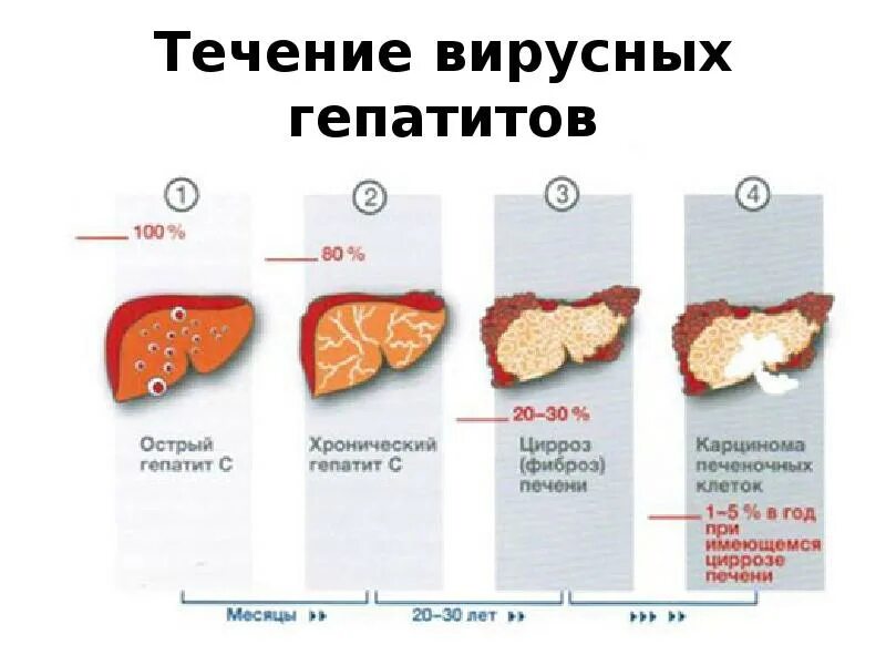 Как живете с гепатитом б