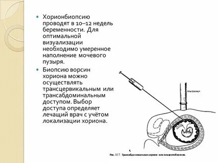 Бвх