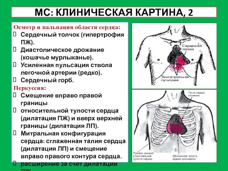 Сердечный толчок пульсация